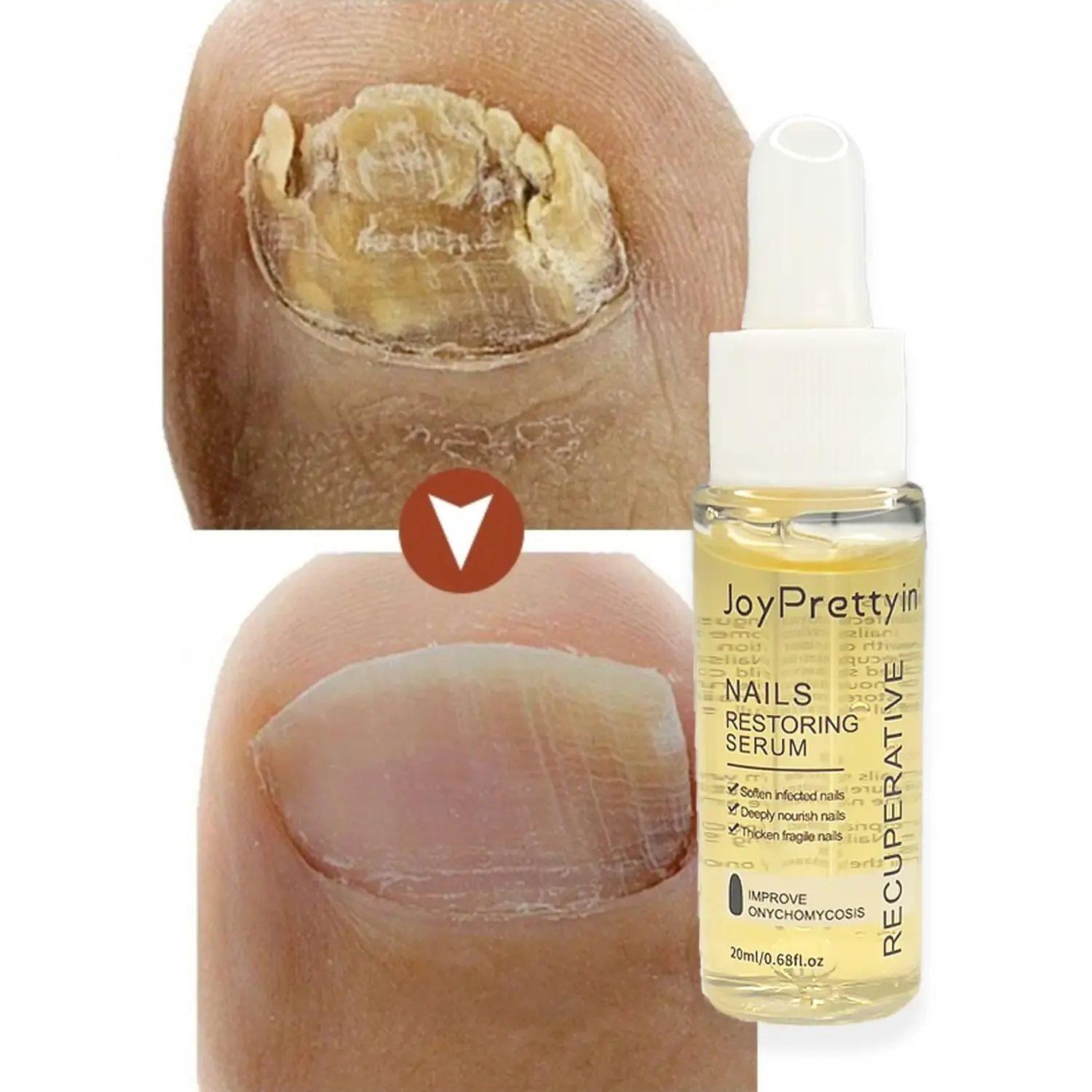Sérum proti plísním s obnovou růstu nehtů, 20 ml